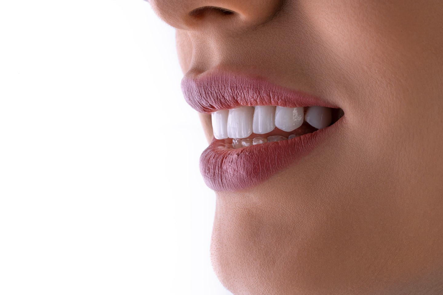 Close up side profile white teeth pink lipstick teeth whitening